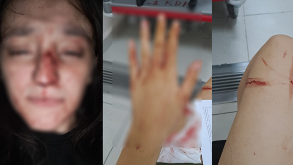 Sultanbeyli’de Eski Sevgili Dehşeti: Genç Kız, “Adalet İstiyorum!”