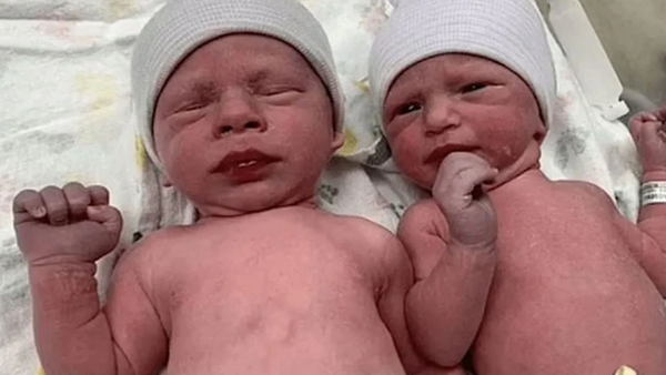 Dünyanın en yaşlı bebekleri 31 yaşında!