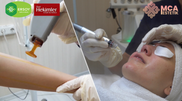 Güzelliğin Merkezi MCA Estetik İle Kalıcı Güzellik…