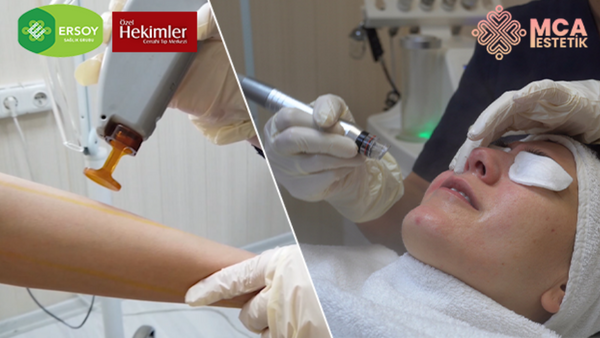 Güzelliğin Merkezi MCA Estetik İle Kalıcı Güzellik…