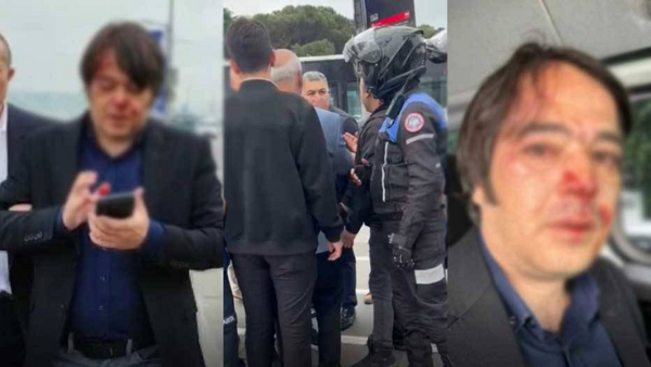 Üsküdar’da kaçak kafe yıkımında İBB personelleri dövüldü